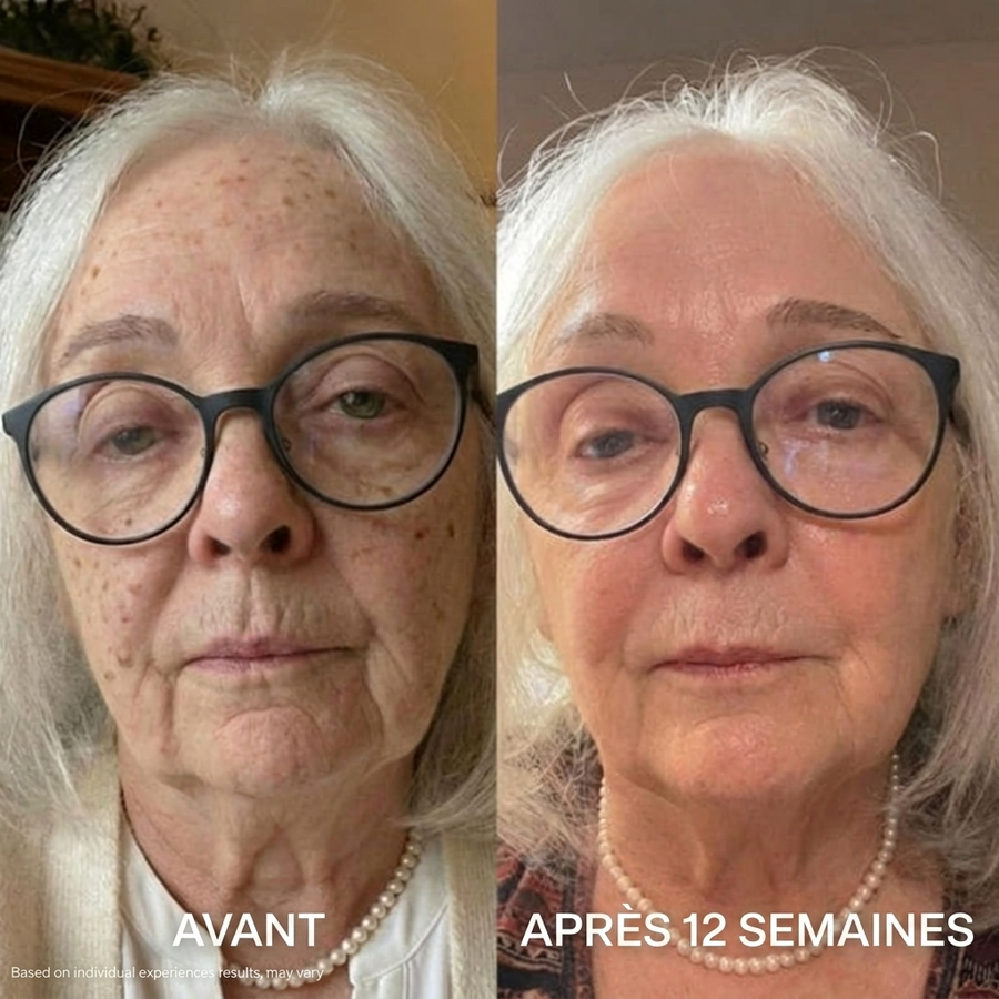 Avant / après 12 semaines — résultats individuels, non garantis
