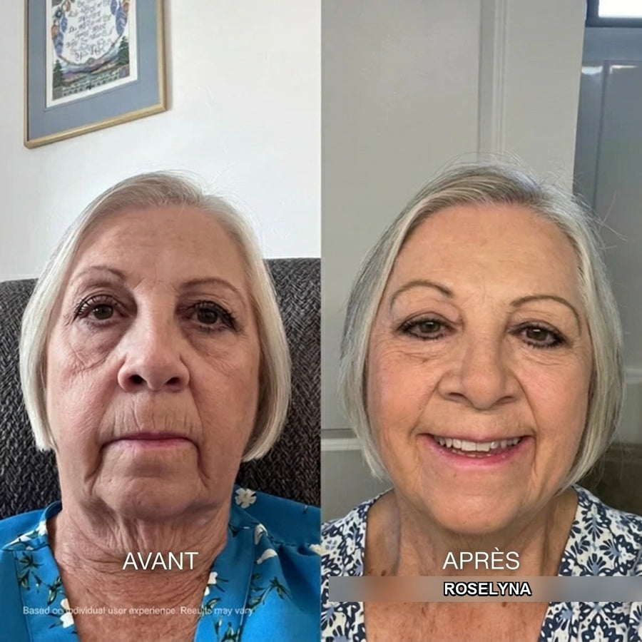 Avant / après Roselyna — résultats individuels
