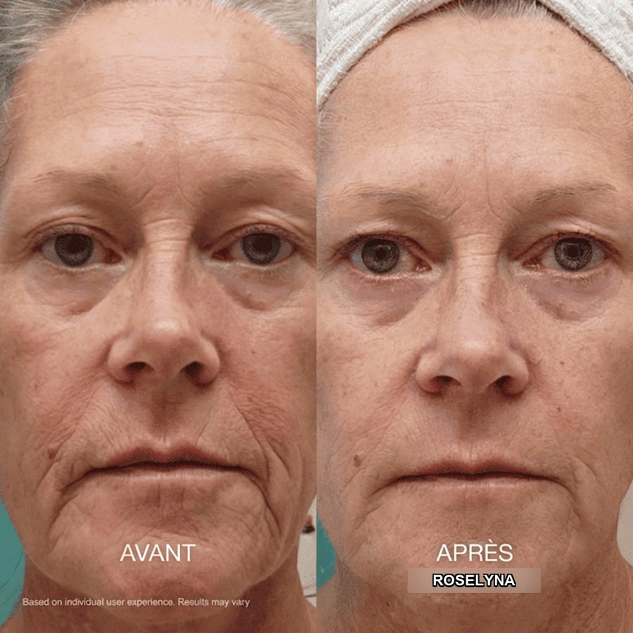Avant / après Roselyna — résultats individuels