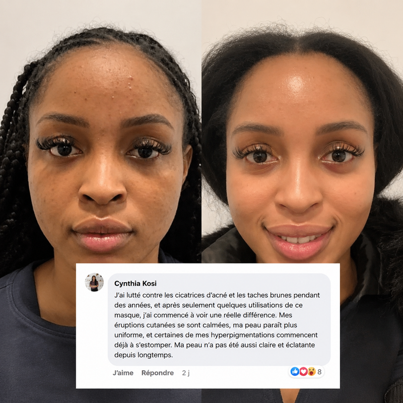 Avis Cynthia K. — avant/après