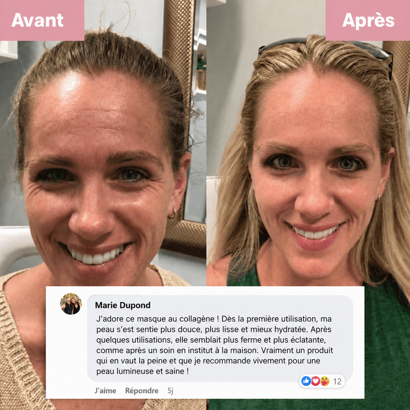 Avis Marie M. — avant/après