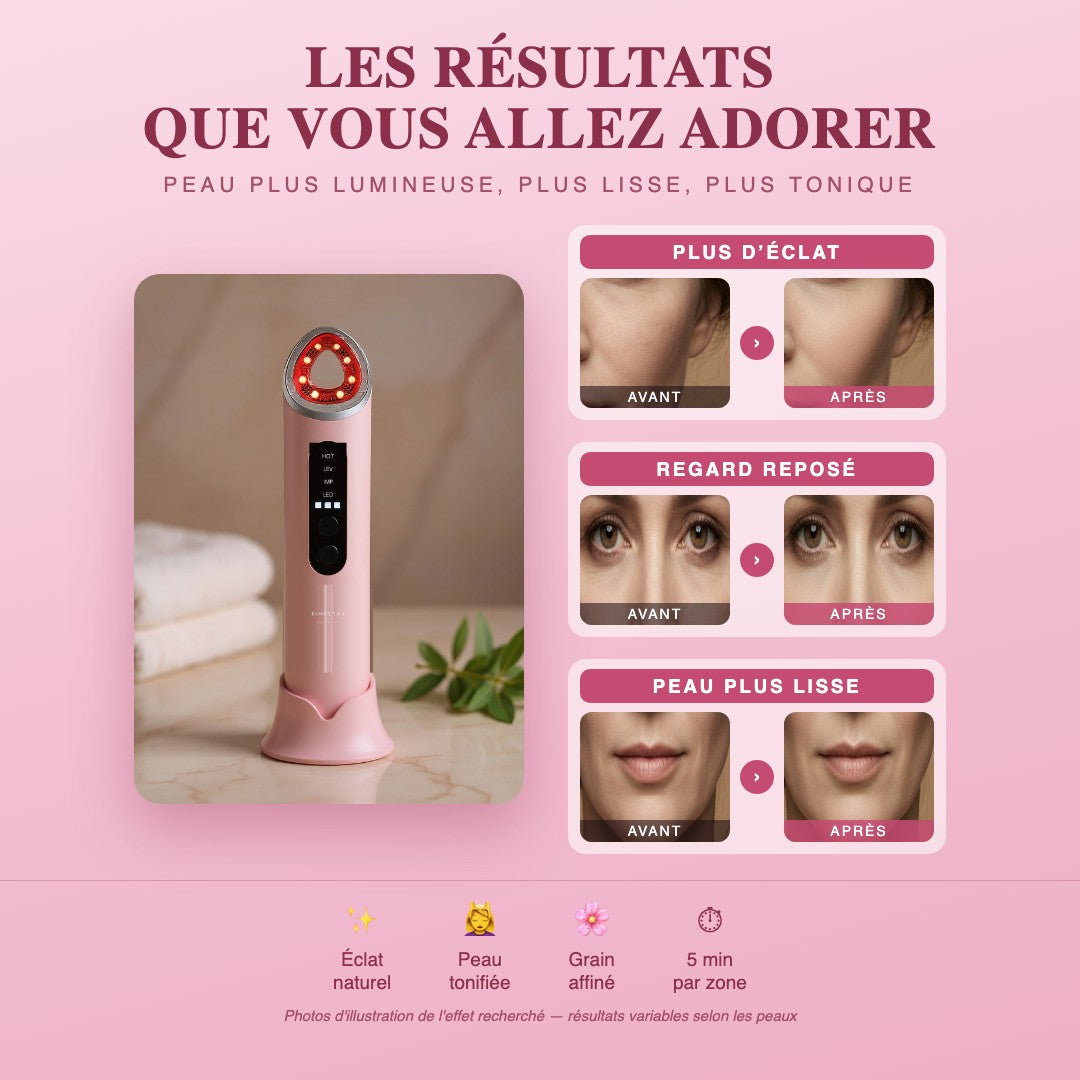 Résultats